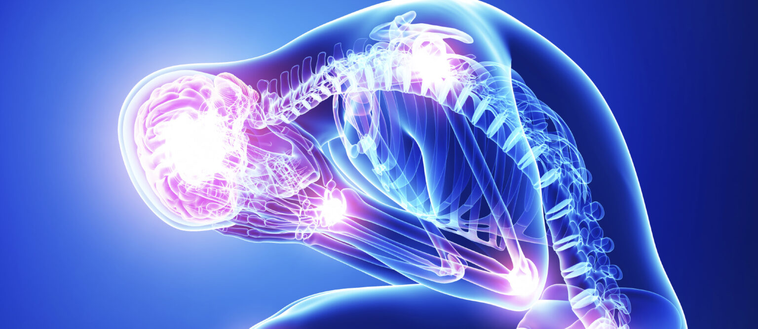 Advances in Imaging of Rheumatoid Arthritis - Clinical Trial Listing ...